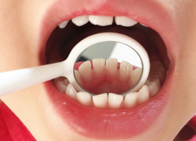 お子さまの予防・治療