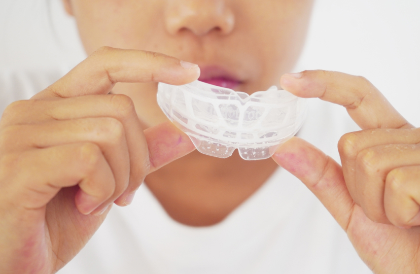 歯並びの矯正・癖の改善